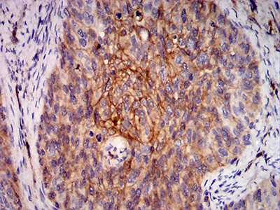 RALB Antibody in Immunohistochemistry (Paraffin) (IHC (P))