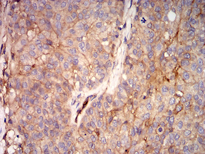 RALB Antibody in Immunohistochemistry (Paraffin) (IHC (P))