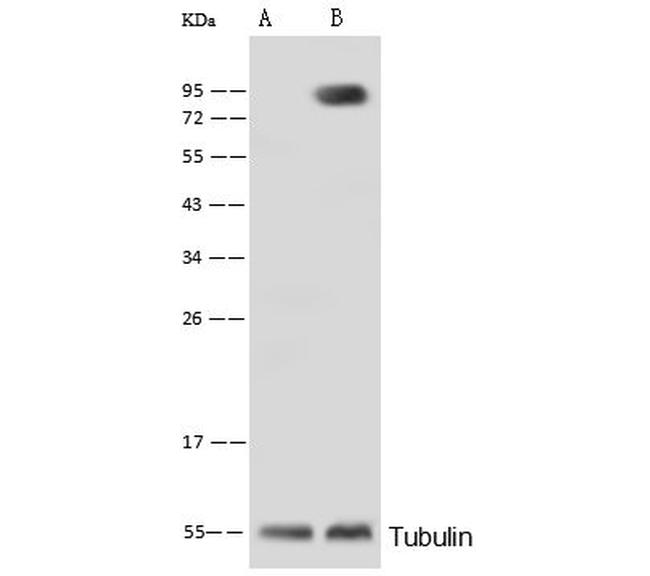 ALPL Antibody in Western Blot (WB)