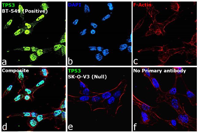 p53 Antibody