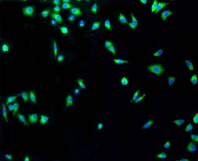 p53 Antibody in Immunocytochemistry (ICC/IF)