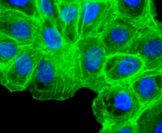 Alpha-Smooth Muscle Actin Antibody in Immunocytochemistry (ICC/IF)