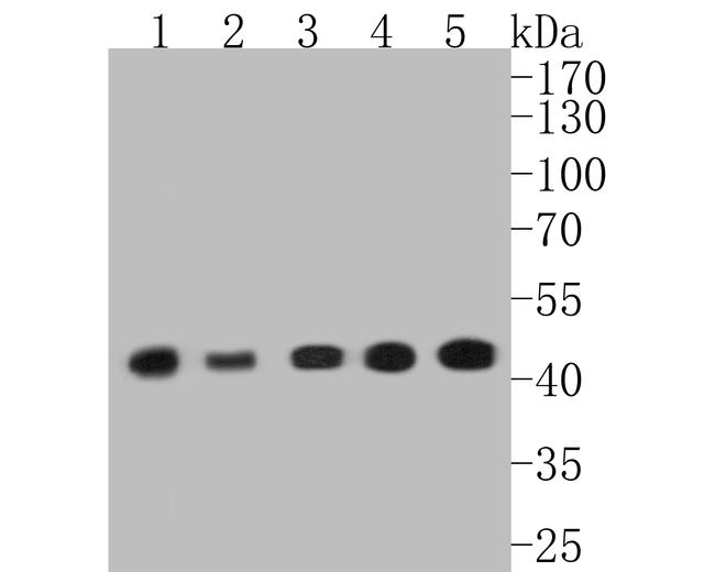 Alpha-Smooth Muscle Actin Antibody in Western Blot (WB)