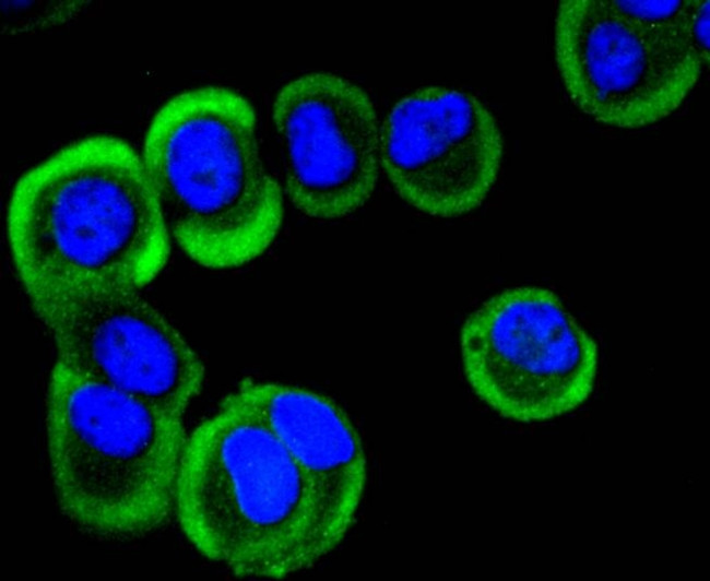 YBX1 Antibody in Immunocytochemistry (ICC/IF)