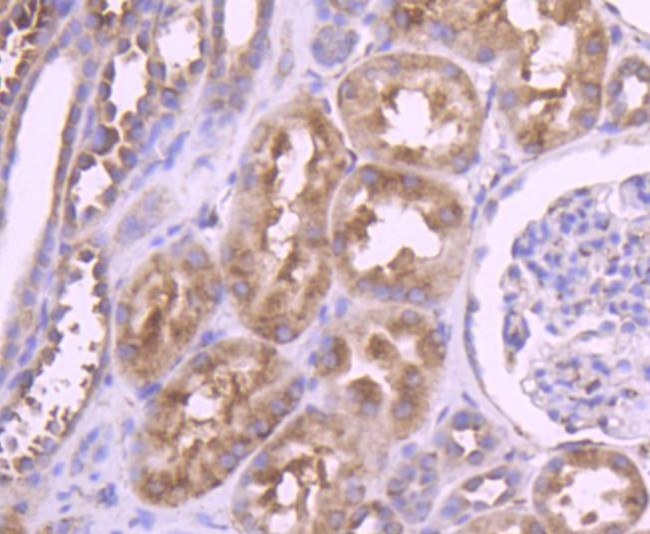 YBX1 Antibody in Immunohistochemistry (Paraffin) (IHC (P))