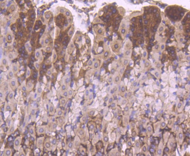 YBX1 Antibody in Immunohistochemistry (Paraffin) (IHC (P))