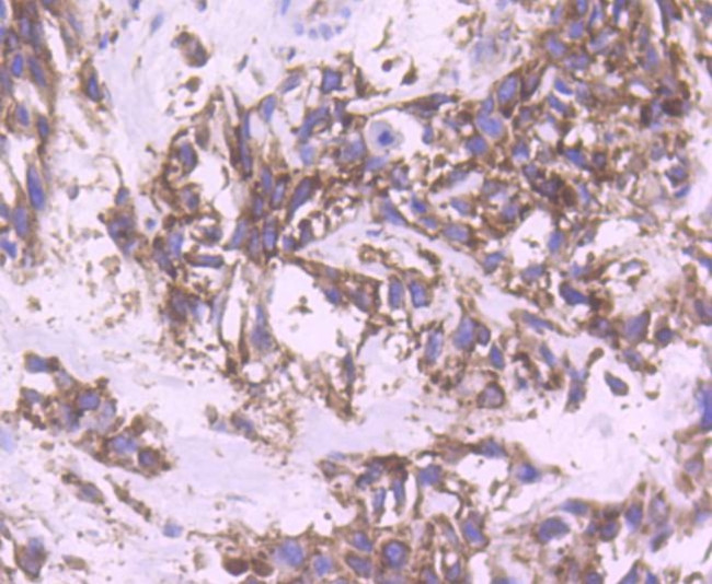 YBX1 Antibody in Immunohistochemistry (Paraffin) (IHC (P))