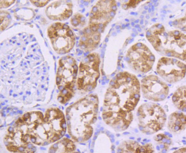 AKT Pan Antibody in Immunohistochemistry (Paraffin) (IHC (P))