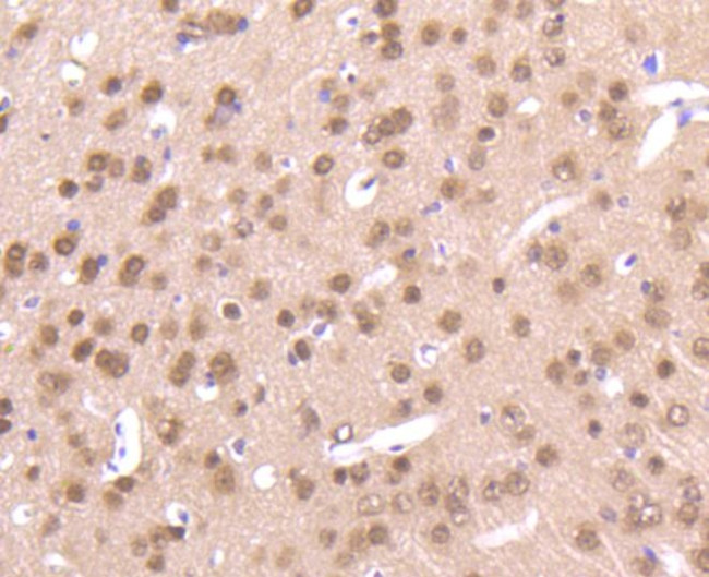 AKT Pan Antibody in Immunohistochemistry (Paraffin) (IHC (P))