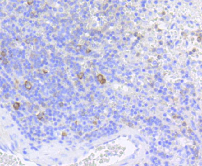 Phospho-eIF4E (Ser209) Antibody in Immunohistochemistry (Paraffin) (IHC (P))