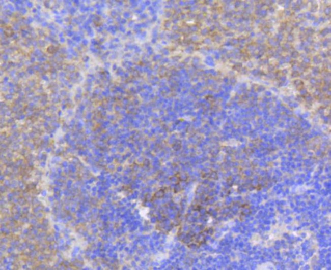 Phospho-eIF4E (Ser209) Antibody in Immunohistochemistry (Paraffin) (IHC (P))