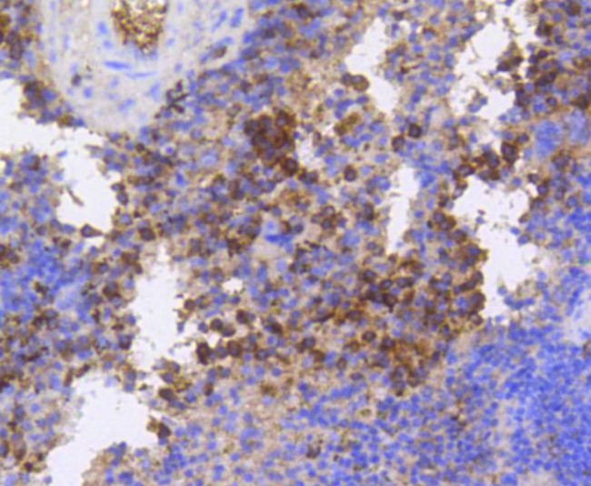 Phospho-eIF4E (Ser209) Antibody in Immunohistochemistry (Paraffin) (IHC (P))