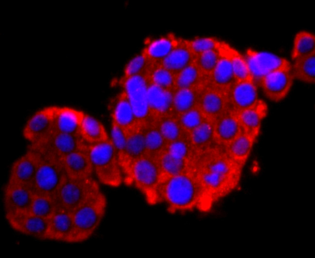 Calbindin D28K Antibody in Immunocytochemistry (ICC/IF)