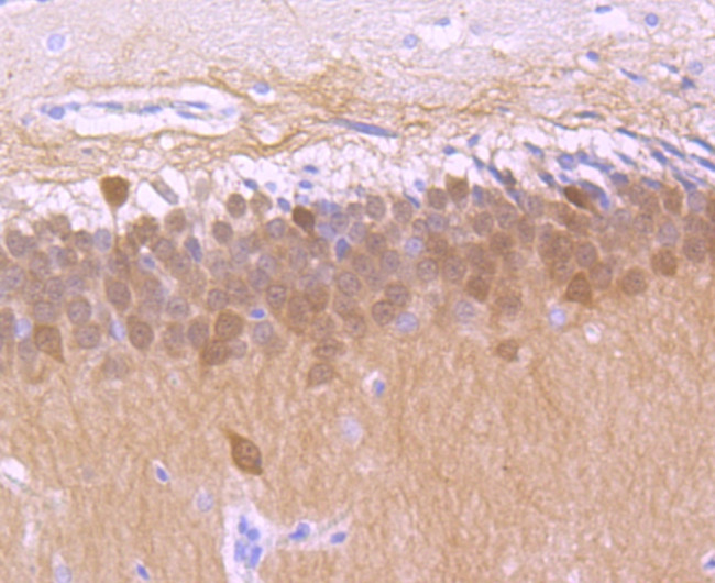 Calbindin D28K Antibody in Immunohistochemistry (Paraffin) (IHC (P))