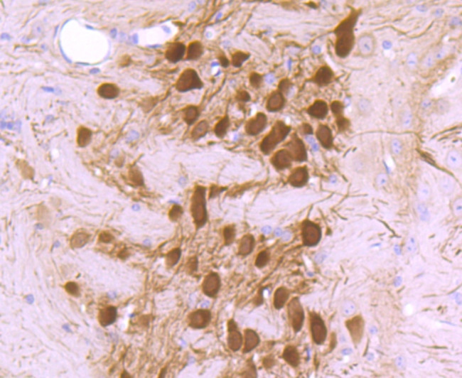 Calbindin D28K Antibody in Immunohistochemistry (Paraffin) (IHC (P))