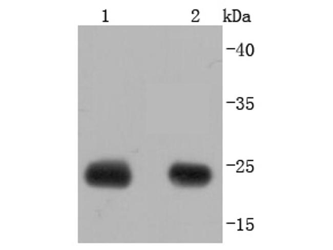 Calbindin D28K Antibody in Western Blot (WB)