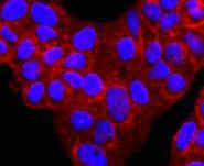 alpha-1 Antitrypsin Antibody in Immunocytochemistry (ICC/IF)