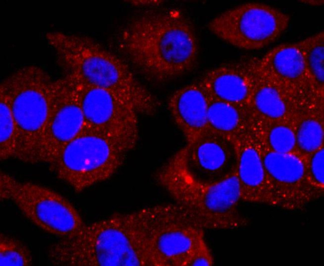 alpha-1 Antitrypsin Antibody in Immunocytochemistry (ICC/IF)