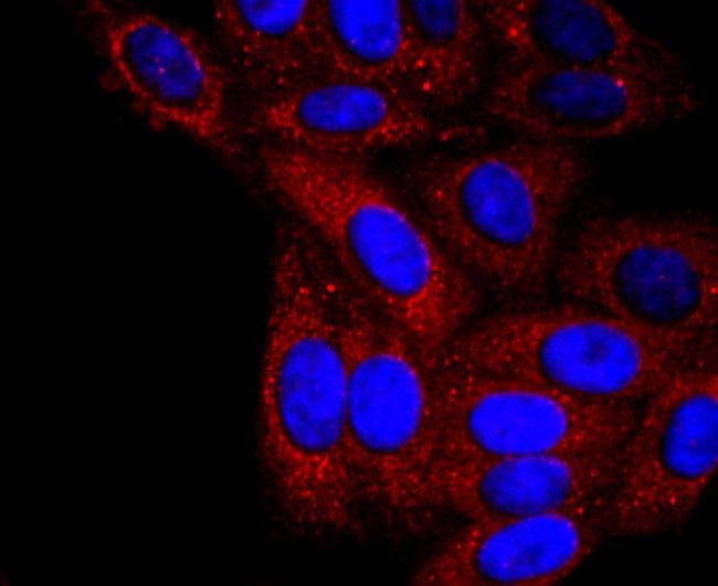 alpha-1 Antitrypsin Antibody in Immunocytochemistry (ICC/IF)