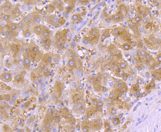 alpha-1 Antitrypsin Antibody in Immunohistochemistry (Paraffin) (IHC (P))