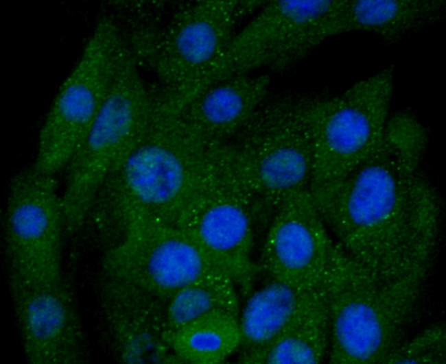 BNIP3 Antibody in Immunocytochemistry (ICC/IF)