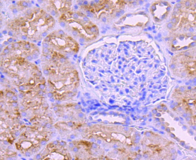 BNIP3 Antibody in Immunohistochemistry (Paraffin) (IHC (P))