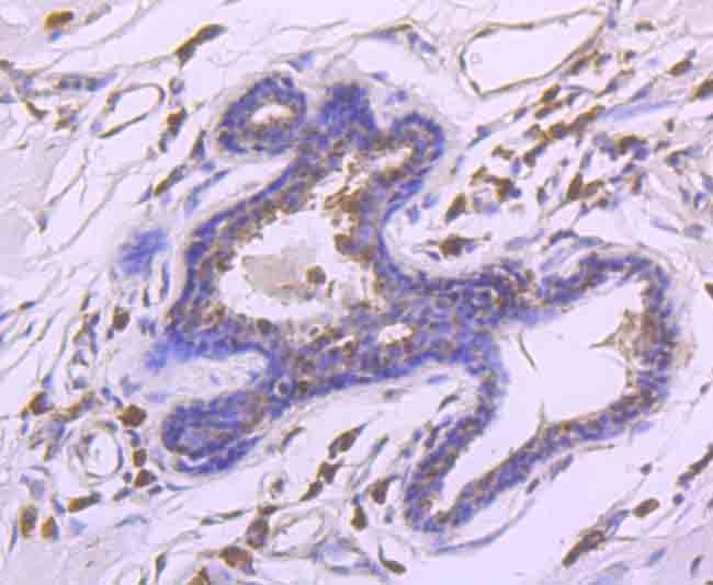 CHD4 Antibody in Immunohistochemistry (Paraffin) (IHC (P))