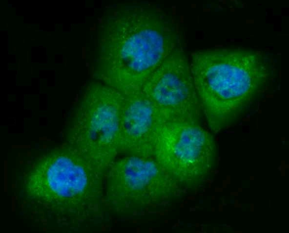 PAK2 Antibody in Immunocytochemistry (ICC/IF)