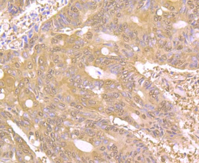 PAK2 Antibody in Immunohistochemistry (Paraffin) (IHC (P))