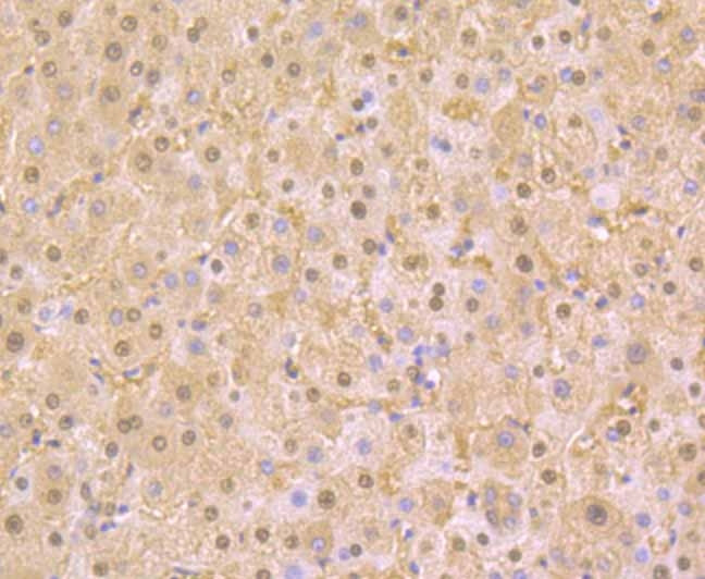 PAK2 Antibody in Immunohistochemistry (Paraffin) (IHC (P))