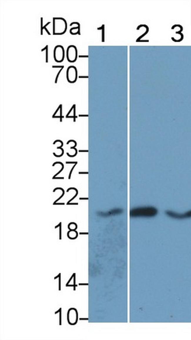 betatrophin Antibody in Western Blot (WB)