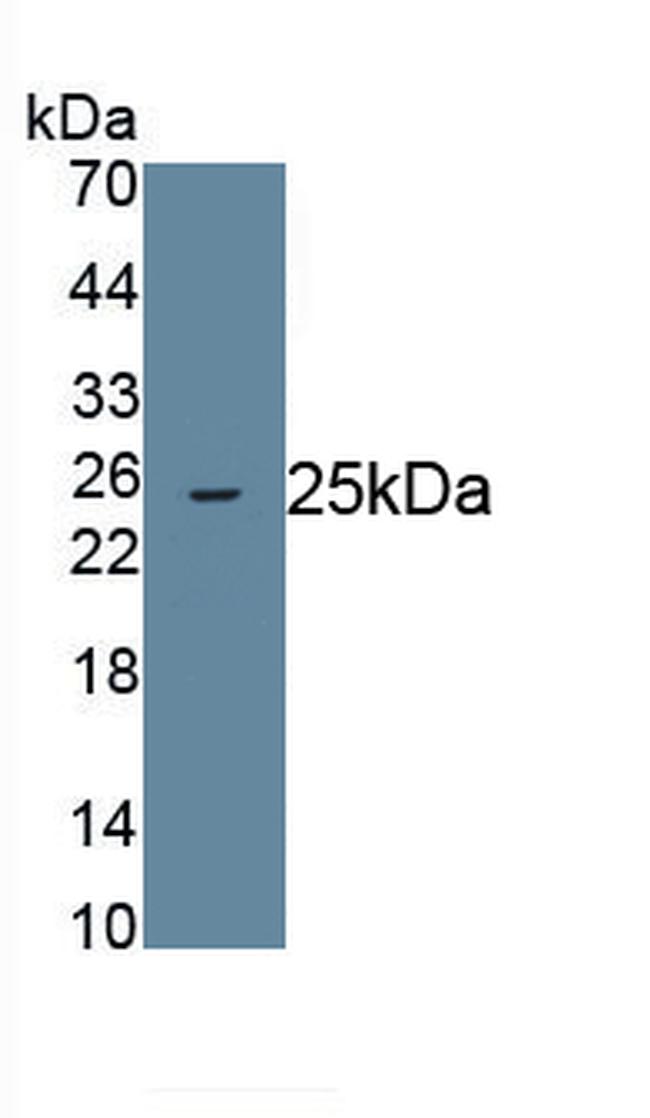 betatrophin Antibody in Western Blot (WB)