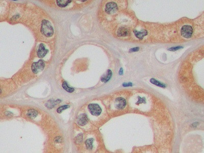 GLUT1 Antibody in Immunohistochemistry (Paraffin) (IHC (P))