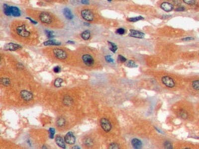 GLUT1 Antibody in Immunohistochemistry (Paraffin) (IHC (P))