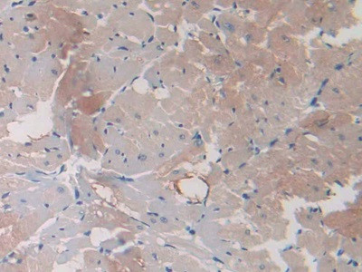 HSP20 Antibody in Immunohistochemistry (Paraffin) (IHC (P))