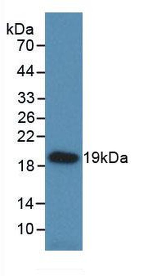 HSP20 Antibody in Western Blot (WB)