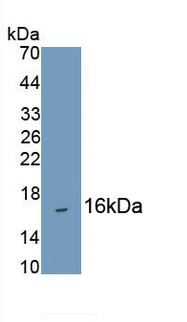 Hemoglobin alpha-1 Antibody in Western Blot (WB)