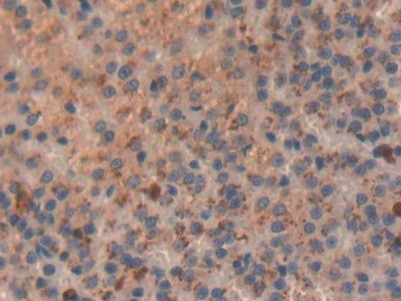 PRG2 Antibody in Immunohistochemistry (Paraffin) (IHC (P))