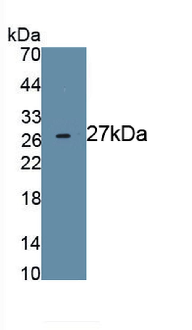 Nephrin Antibody in Western Blot (WB)