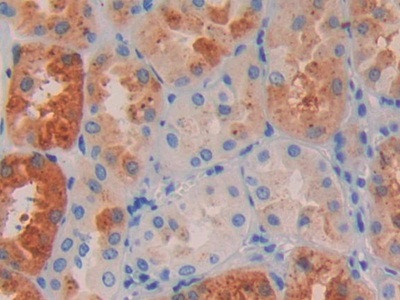 RBP4 Antibody in Immunohistochemistry (Paraffin) (IHC (P))