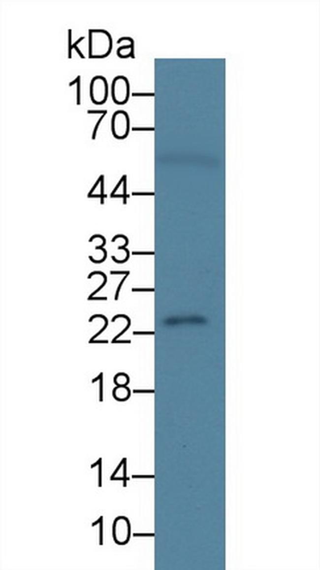 RBP4 Antibody in Western Blot (WB)