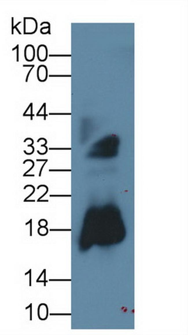 RNASE2 Antibody in Western Blot (WB)