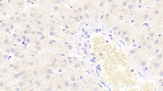 S100A9 Antibody in Immunohistochemistry (Paraffin) (IHC (P))