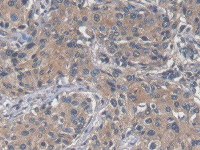 SAA Antibody in Immunohistochemistry (Paraffin) (IHC (P))