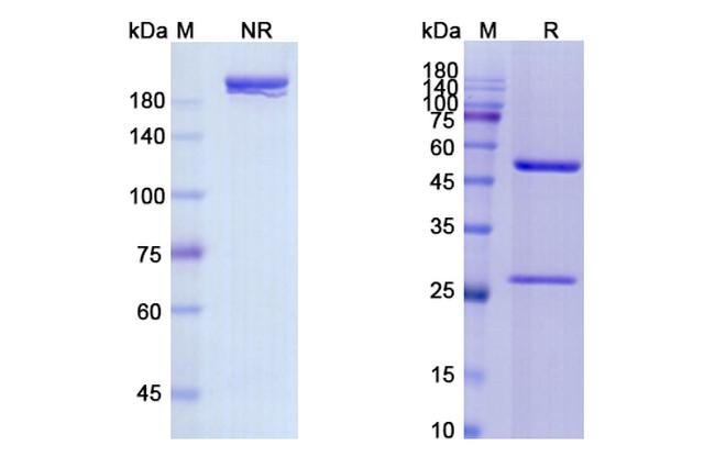 Panitumumab Antibody in SDS-PAGE (SDS-PAGE)