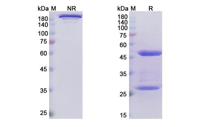 Narsoplimab Antibody in SDS-PAGE (SDS-PAGE)