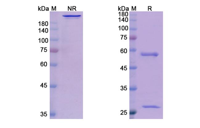 Talizumab Chimeric Antibody in SDS-PAGE (SDS-PAGE)