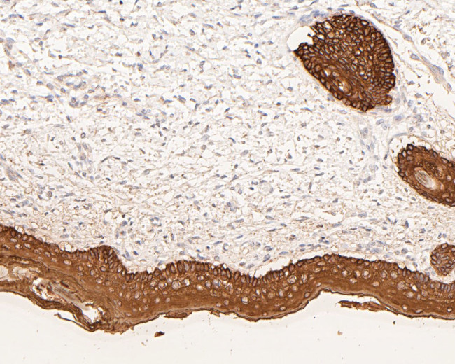 Cytokeratin 5/6 Antibody in Immunohistochemistry (Paraffin) (IHC (P))