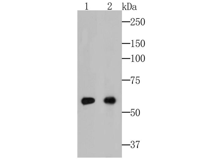 Cytokeratin 5/6 Antibody in Western Blot (WB)