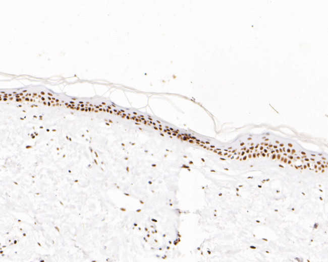 MSH6 Antibody in Immunohistochemistry (Paraffin) (IHC (P))